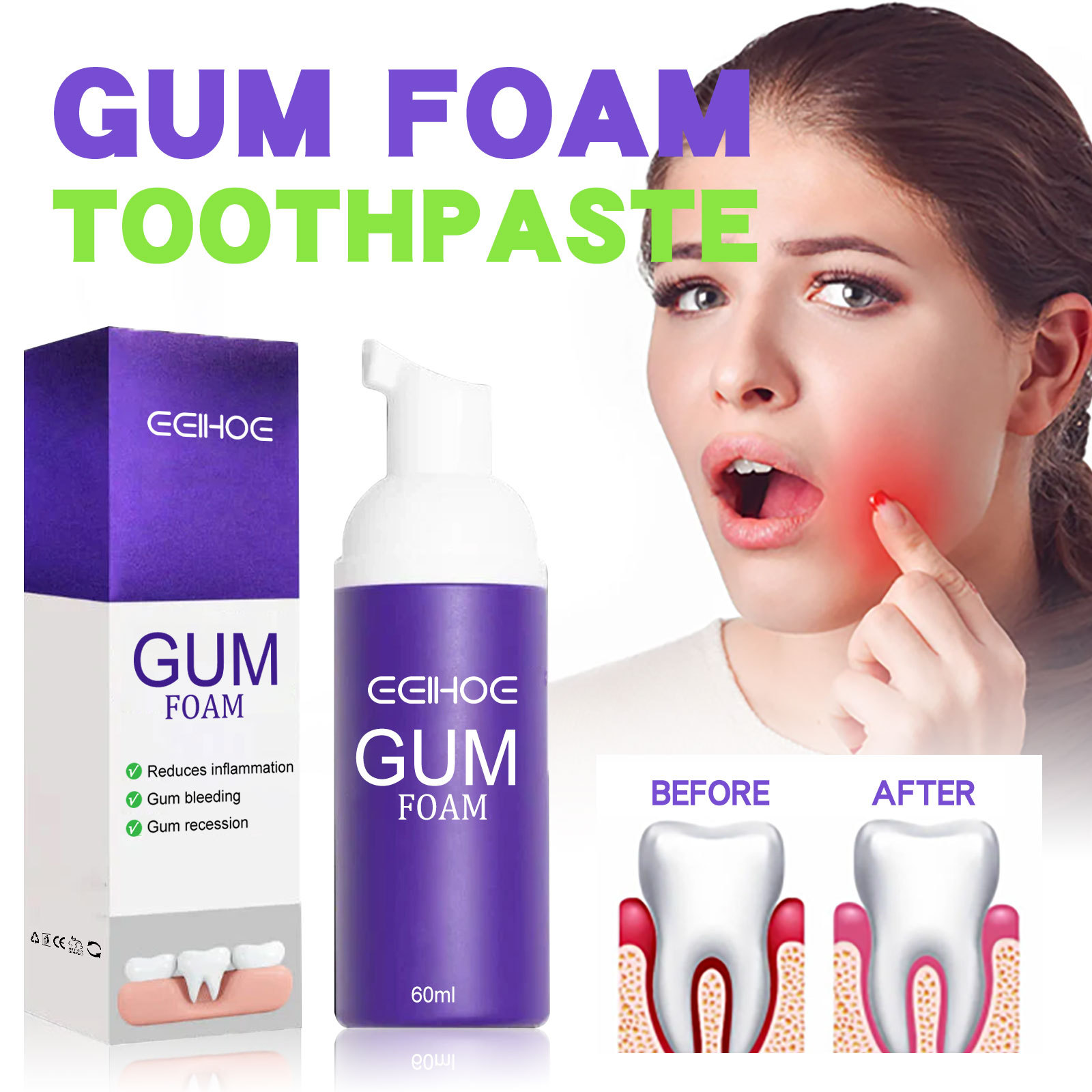 Teeth Whitening Mousse - Mousse blanqueador de dientes V34, 60ml,