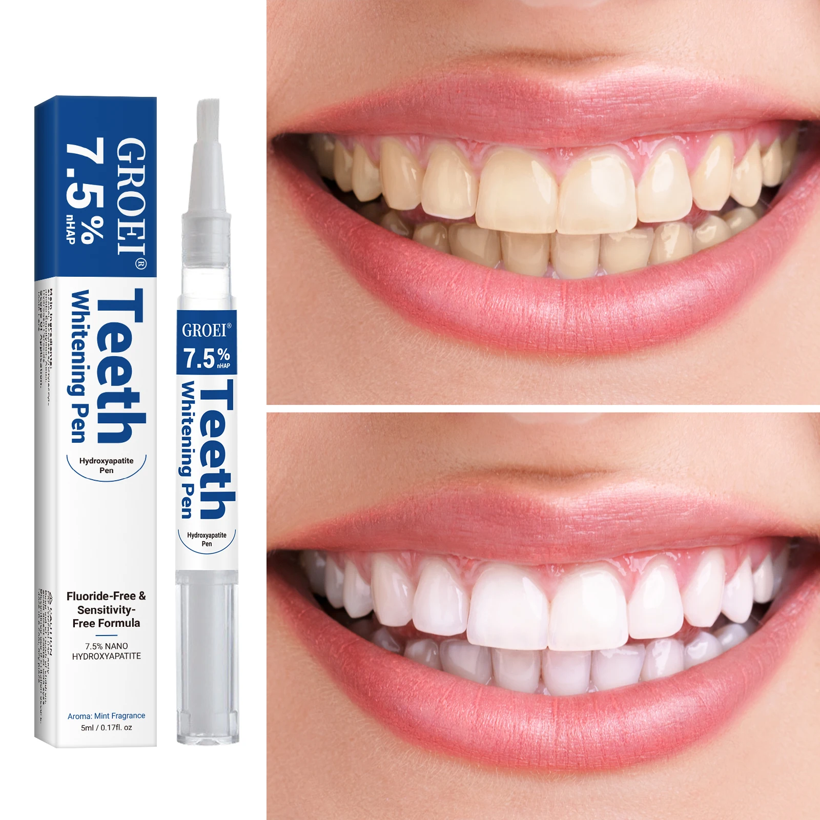 Pluma blanqueadora de dientes  - Teeth Whitening Near Me reseña y precio