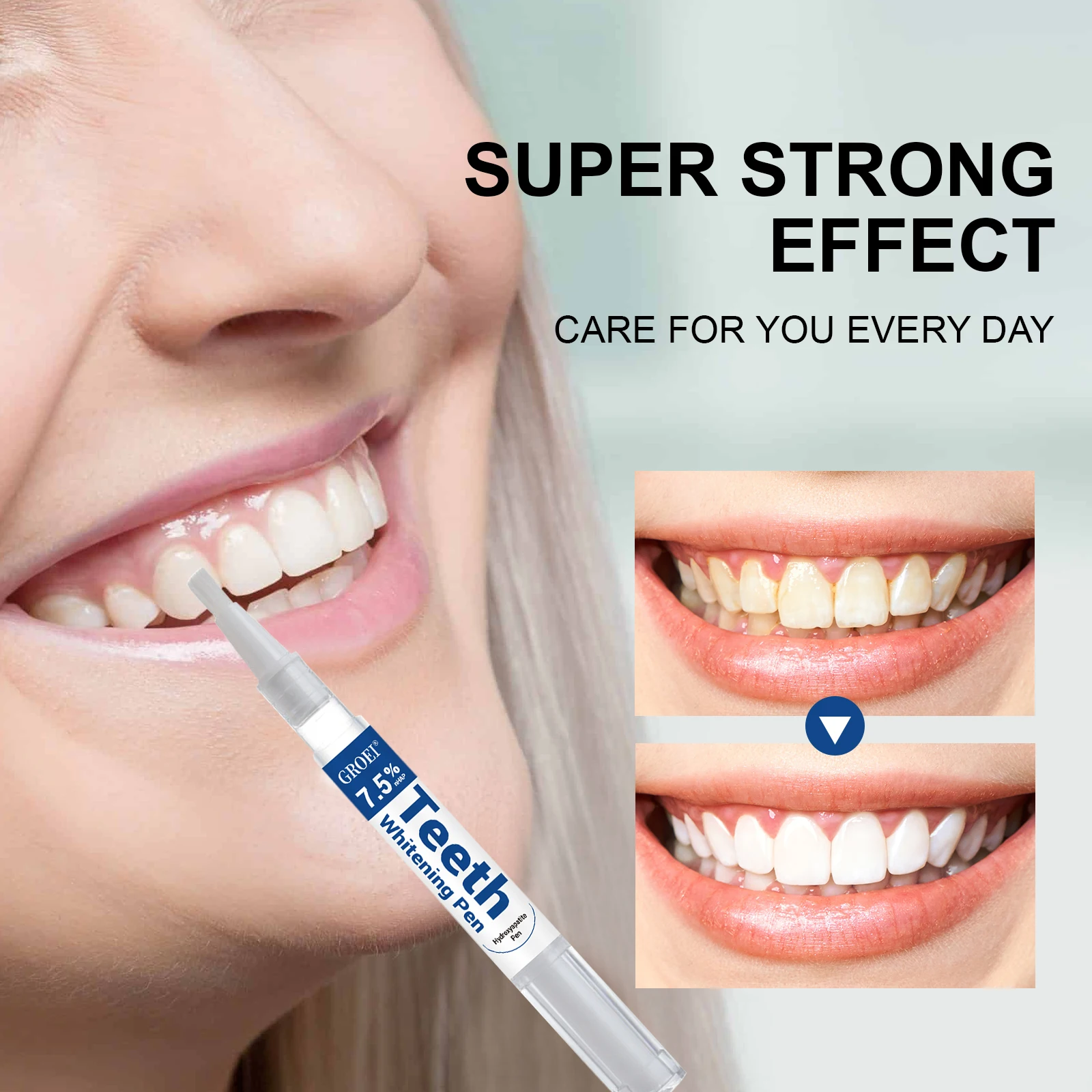 Pluma blanqueadora de dientes  - Teeth Whitening Near Me reseña y precio