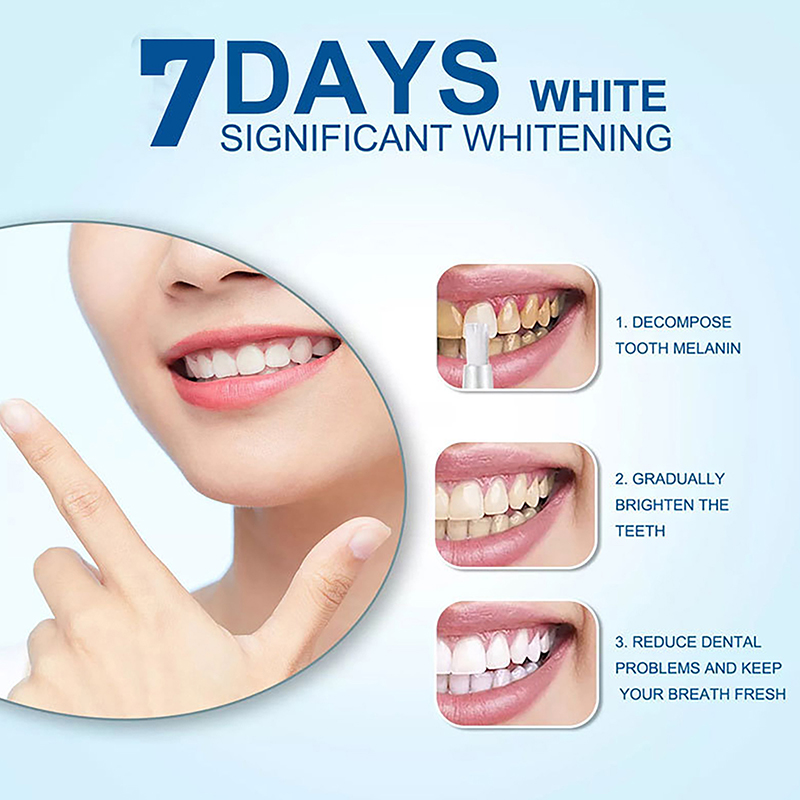 Lápiz Blanqueador Dental Profe - Teeth Whitening Bleaching Kit reseña y precio