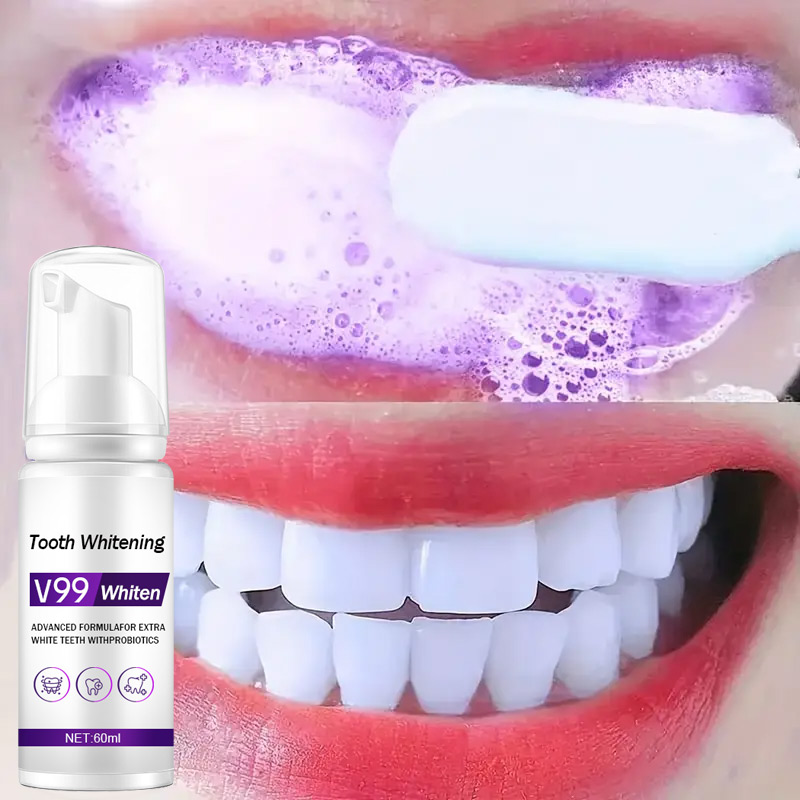 Mousse V99 pasta de dientes li - Teeth Whitening Mousse reseña y precio