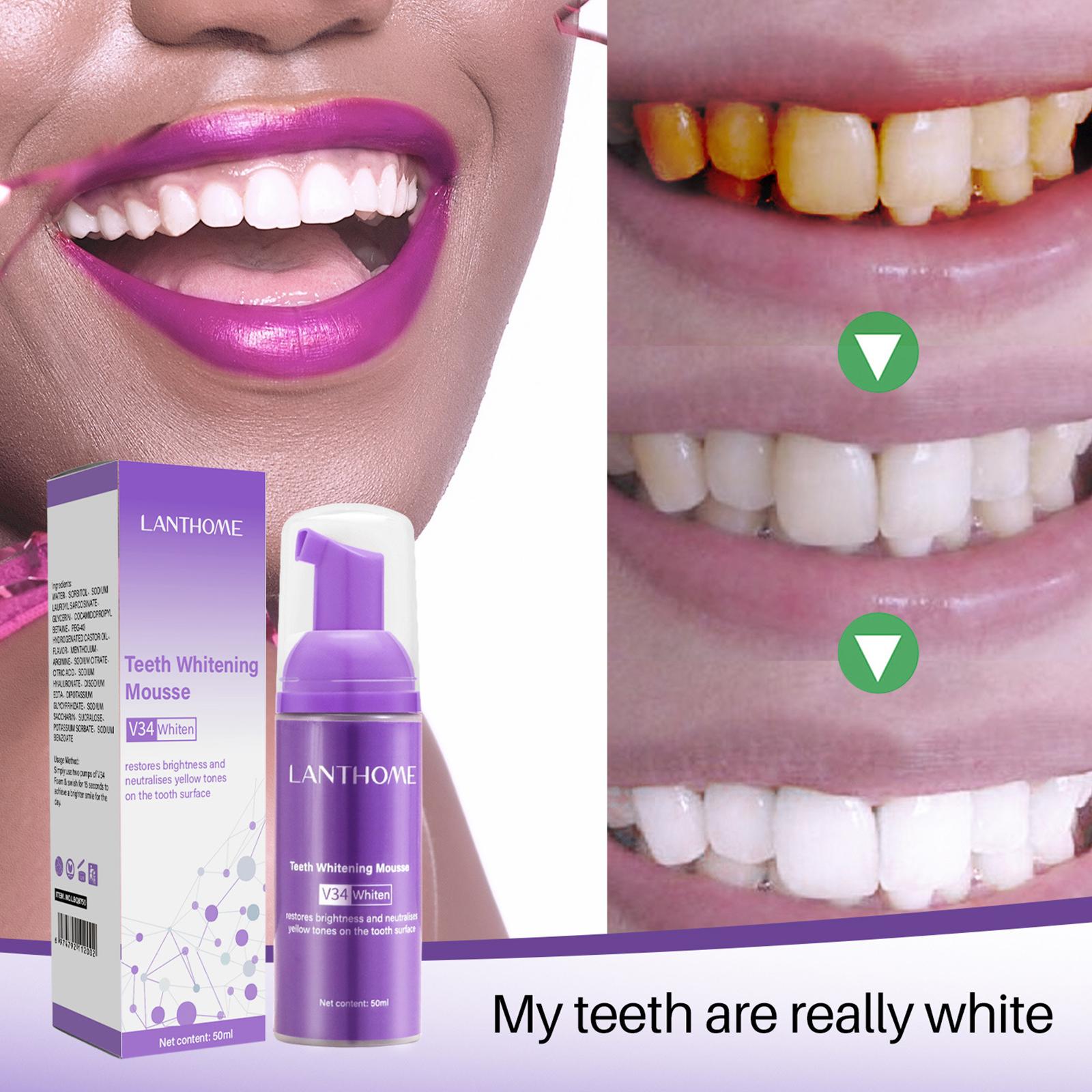 Pasta de dientes V34 Mousse pa - Teeth Whitening Mousse reseña y precio