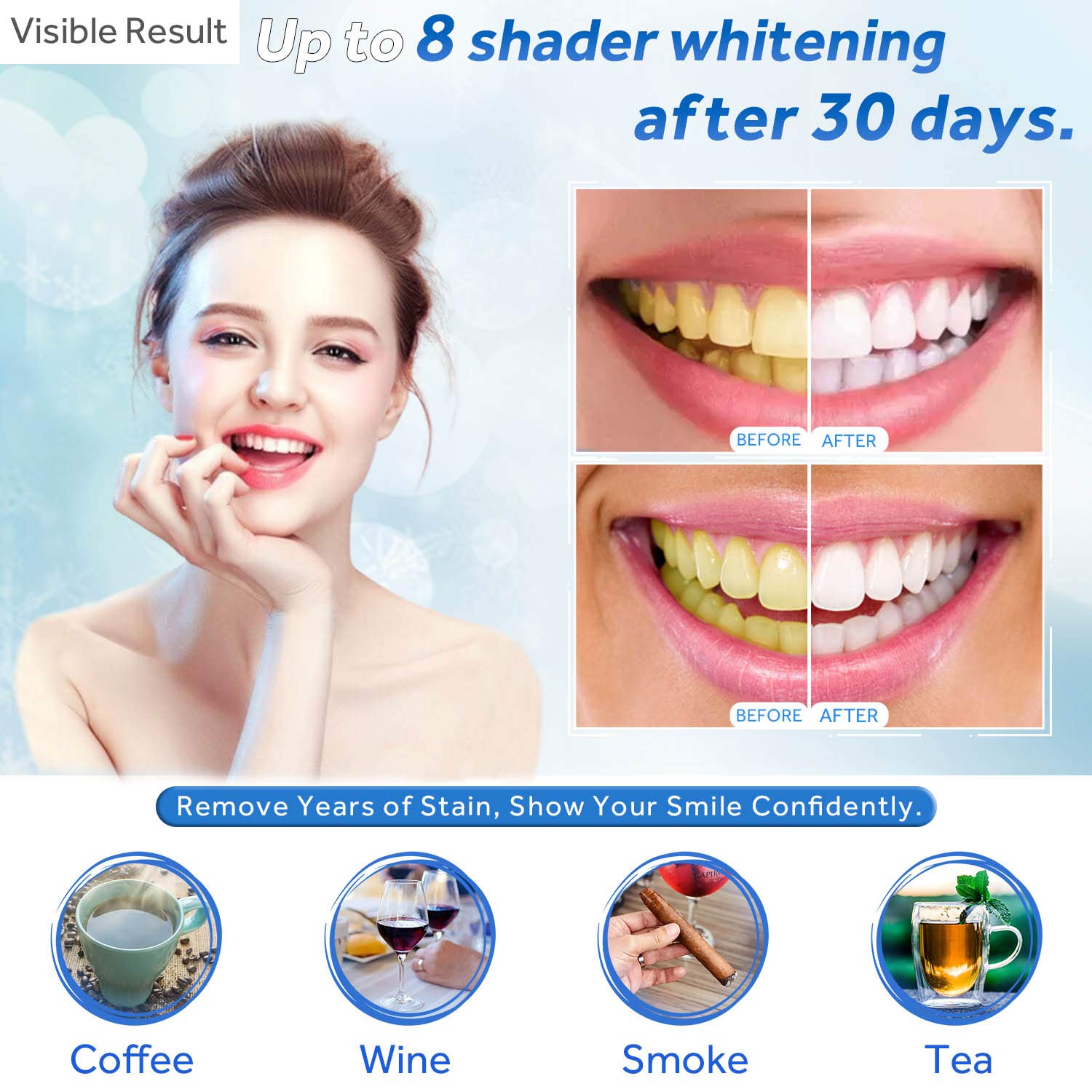 Jeringa de repuesto de Gel par - Teeth Whitening Bleaching Kit reseña y precio