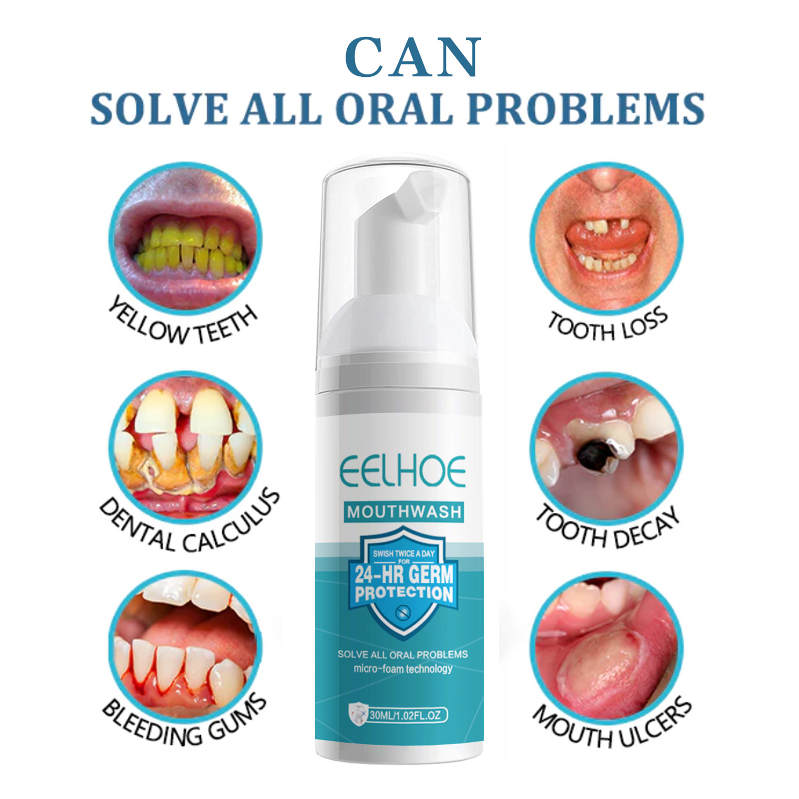 EELHOE blanqueamiento dental l - Teeth Whitening Mousse reseña y precio