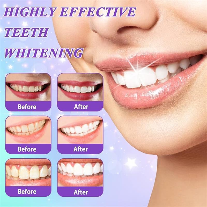 Pasta Dental Blanqueadora 9D P - Teeth Whitening Mousse reseña y precio