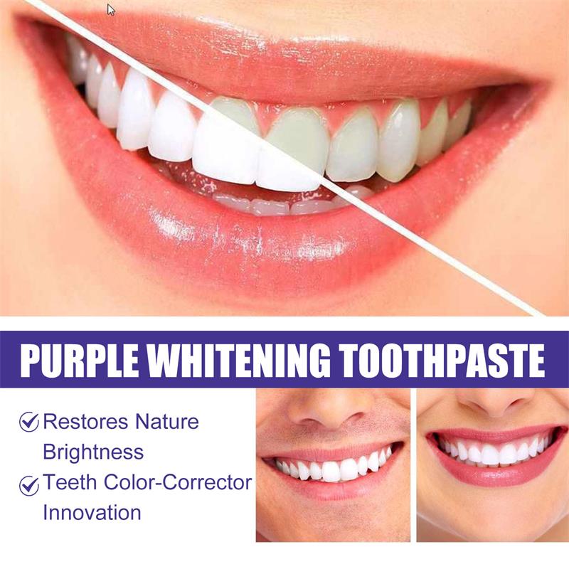 Pasta Dental Blanqueadora 9D P - Teeth Whitening Mousse reseña y precio