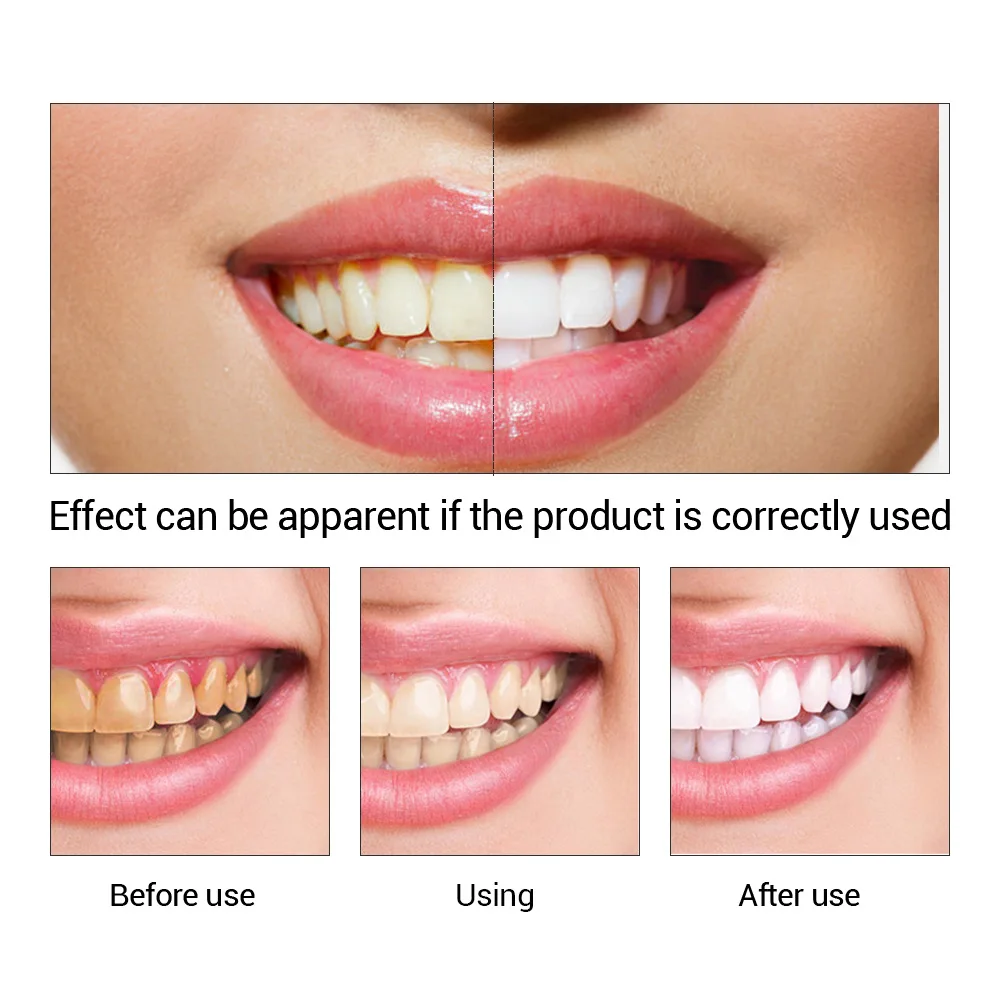 FTEENPLY-esencia para blanquea - Teeth Whitening Bleach reseña y precio