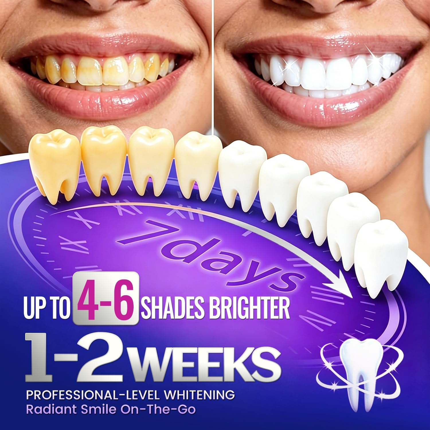 1/7 Pares de Tiras Blanqueador - Teeth Whitening Retainer reseña y precio