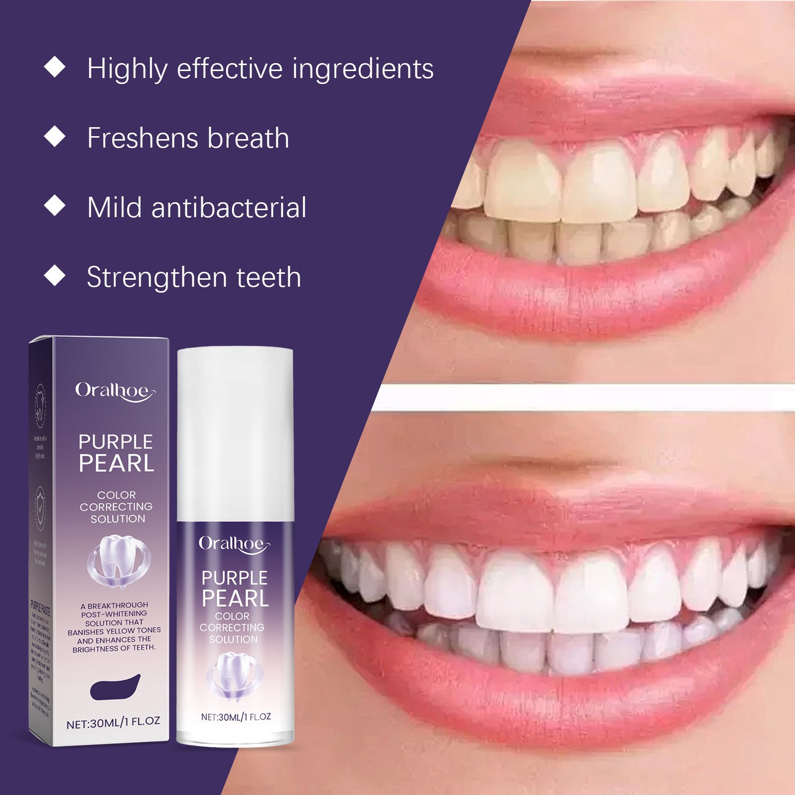 Nueva Mousse Blanqueadora de D - Teeth Whitening Mousse reseña y precio