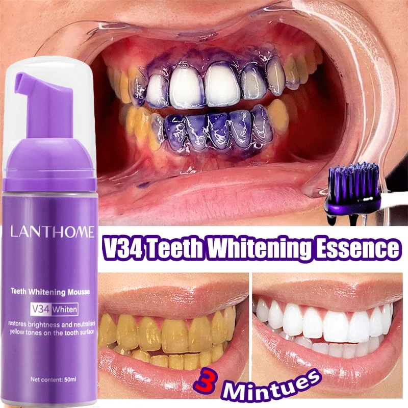 V34 blanqueamiento Dental Mous - Teeth Whitening Mousse reseña y precio