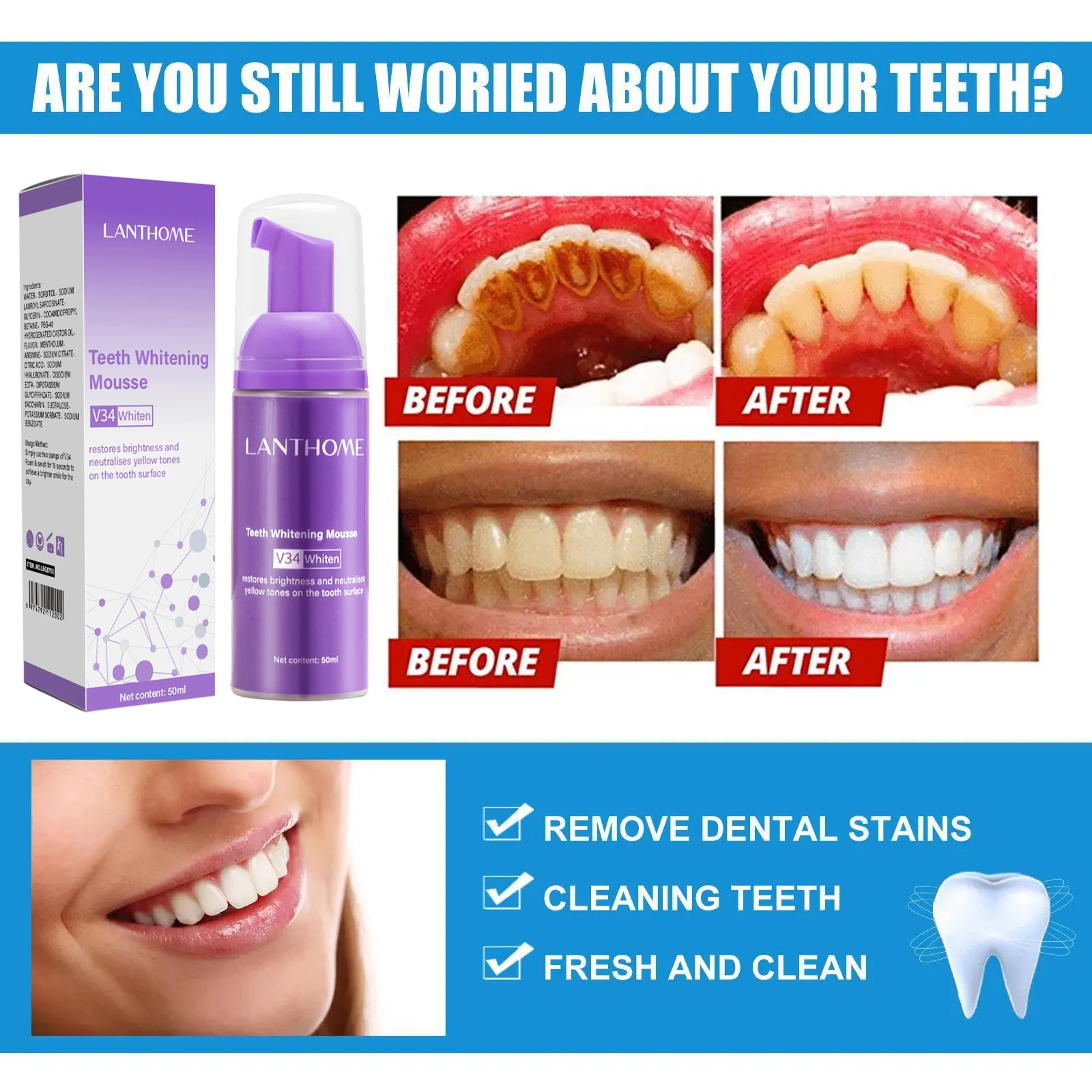 V34 blanqueamiento Dental Mous - Teeth Whitening Mousse reseña y precio