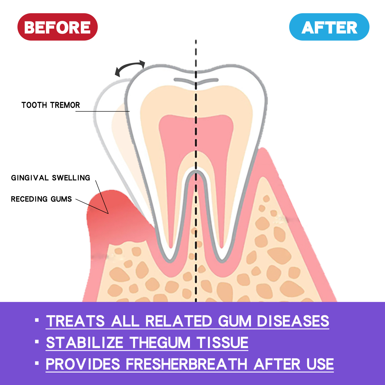 Mousse blanqueador de dientes  - Teeth Whitening Mousse reseña y precio