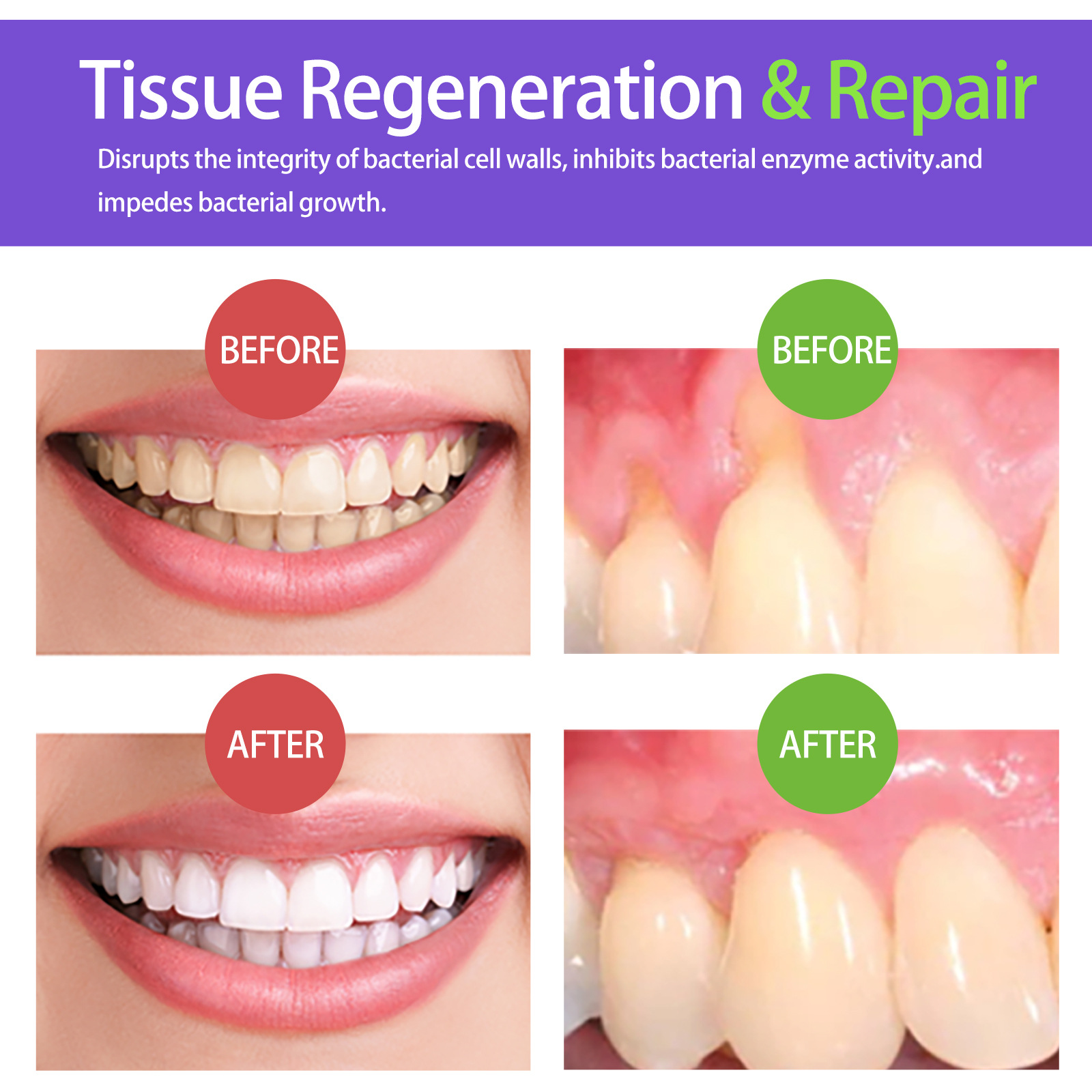 Mousse blanqueador de dientes  - Teeth Whitening Mousse reseña y precio